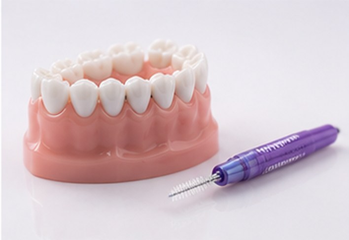 Zahnmodell mit gesundem Zahnfleisch und Interdentalbürste